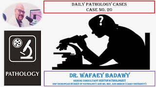 DAILY PATHOLOGY CASES CASE NO 20 BY DR WAFAEY BADAWY [upl. by Nivrag]