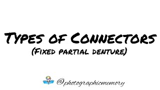 Types of connectors  Fixed partial denture [upl. by Zephan]