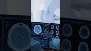 What A Doctor Wants You To Know Before Your MRI Scan 🏥🧲 nurse doctor mri health info medical [upl. by O'Hara]