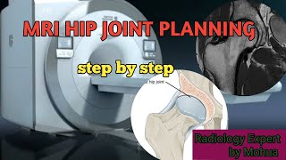 MRI HIP JOINT PLANNING  STEP BY STEP [upl. by Eiramac]