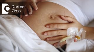 Can women with Cervical stitches walk during pregnancy  Dr Shefali Tyagi [upl. by Aneres]