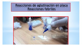 Clase 6  Reacciones febriles [upl. by Mckeon674]