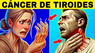 8 Signos Extraños de CÁNCER DE TIROIDES Síntomas de Cáncer de Tiroides [upl. by Myke]