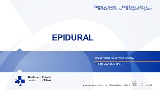 4 Epidural [upl. by Chatterjee]