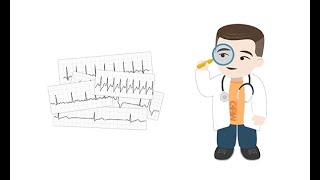 Making sense of common Holter ECG findings [upl. by Fulbert965]