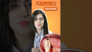 Dental Erosion  Dr Ayesha Zubair [upl. by Schell]