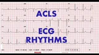 ACLS  ECG rhythm recognition amp management Part 1 [upl. by Anived]