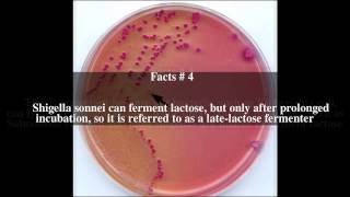 SorbitolMacConkey agar Top  8 Facts [upl. by Werdma]