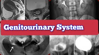 Radiology Viva Cases  200211  Genitourinary System Exam Cases medical radiology ultrasound [upl. by Albright]