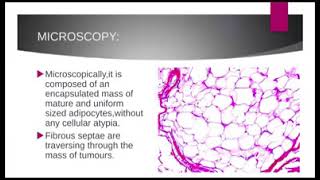 LIPOMA amp LEIOMYOMA General Pathology Practical  Learning Pathology [upl. by Thistle]