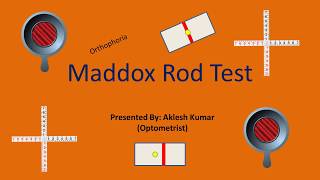 Maddox Rod Test [upl. by Shanon]