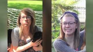 Bells palsy One Loyola patients story [upl. by Laine]