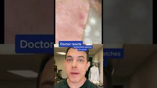 Do hydrocolloid patches work Dermatologist answers  208SkinDoc [upl. by Rosenberger]