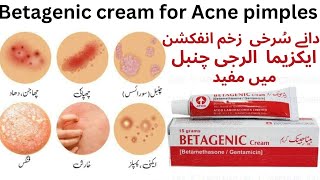 Cream Betagenic Uses And Price In PakistanShahid Madicine Info [upl. by Kauppi331]