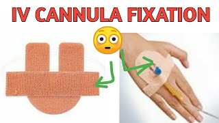 IV Cannula Fixation  IV Cannula Fixator Uses  How To Apply IV Cannula Fixator cannula Fixator [upl. by Secrest906]