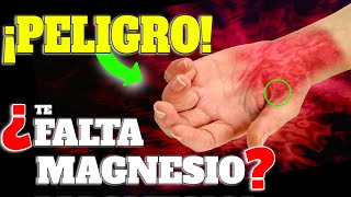 ¡PRINCIPALES SINTOMAS de FALTA de MAGNESIO ALIMENTOS y SUPLEMENTOS para RECUPERAR el MAGNESIO [upl. by Putscher]