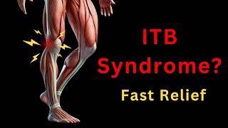 Illiotibial Band Syndrome ITB  Immediate Pain Relief [upl. by Hannad]