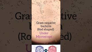 Bacteria under Microscope🔬gram positive vs gram negative bacteriamicrobiology [upl. by Carita97]