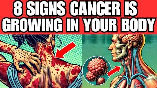 DONT MISS THESE 8 EARLY SIGNS OF CANCER – IT COULD SAVE YOUR LIFE [upl. by Accalia]