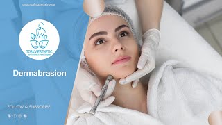 Dermabrasion in Turkey 45 Minutes  Turk Aesthetic [upl. by Jacklyn]