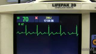 EKG Training Watching and Interpreting the Defibrillator Monitor [upl. by Jemie]