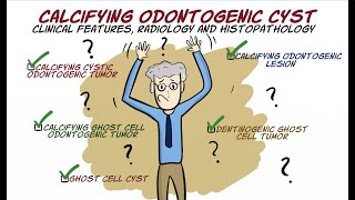 Calcifying Odontogenic Cyst COC [upl. by Mide]