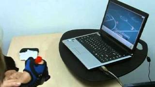 Radial nerve palsy rehabilitation using HandTutor system [upl. by Novahc]