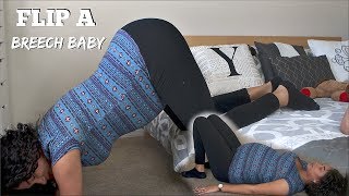 HOW TO FLIP BREECH BABY  YANELY AMADIZ [upl. by Aivul189]