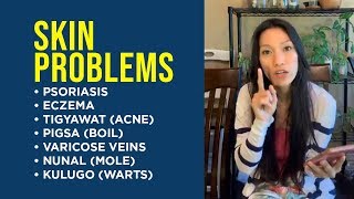 Dr Farrah on Skin Problems Psoriasis AcnePimples Boil Eczema Varicose Veins Mole Warts [upl. by Esilahs]