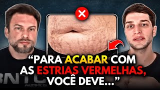 COMO SUMIR COM AS ESTRIAS VERMELHAS DE UMA VEZ  Muzy Explica [upl. by Gnagflow]