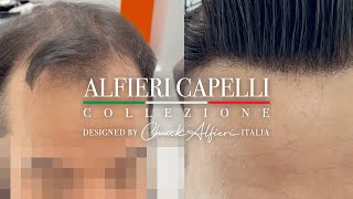 Chuck Alfieri Capelli Hair and Hairline Replacement Men amp Women [upl. by Pembroke]