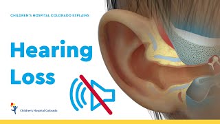 Pediatric Hearing Loss [upl. by Essiralc]