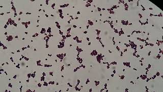 Staphylococcus hemolyticus in Gram Staining [upl. by Three]