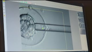 What Happens During an Embryo Biopsy [upl. by Aicilaana]