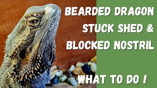 Bearded dragon stuck shed amp blocked nostril and how to treat it [upl. by Azyl]