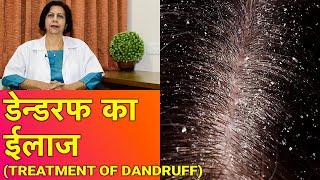 डेन्डरफ  रूसी का ईलाज  Dandruff Treatment [upl. by Yelnats]