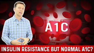 Normal A1C But Why Do I have Insulin Resistance – Dr Berg [upl. by Arturo]