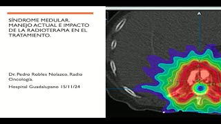 Síndrome Medular  Urgencias Oncológicas [upl. by Glover672]