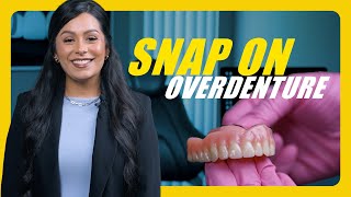 snap on dentures vs regular dentures [upl. by Neruat]