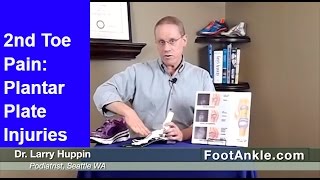 Second Toe Pain and Plantar Plate Tears  Seattle Podiatrist [upl. by Strickland]