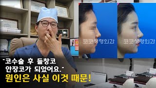 7편 코수술 후 들창코 안장코 원인은 바로 이것 일수도 있습니다 비중격연골 및 해결방안 [upl. by Apple]