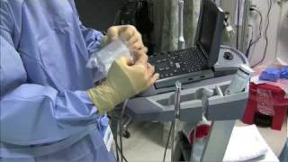 Sterile Sheath for Ultrasound Guided Procedure Single Operator Technique [upl. by Notsgnik]