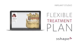 3Shape Implant Studio  Flexible treatment plan [upl. by Ahsenrat]