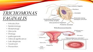 Trichomonas vaginalis [upl. by Ferrick]