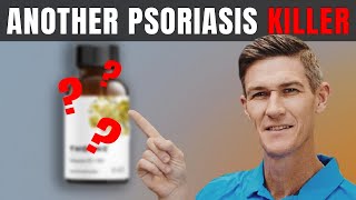 Best Psoriasis Treatment Supplement  How to Get Rid of Psoriasis Naturally [upl. by Hakan]