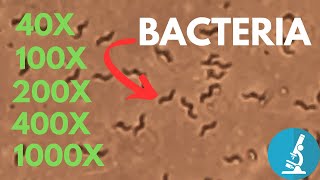 Bacteria under Microscope at Different Magnification  Do you really need 1000x [upl. by Rosenwald]