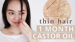 30 Days of Castor Oil on My Thin Hair [upl. by Gualtiero]