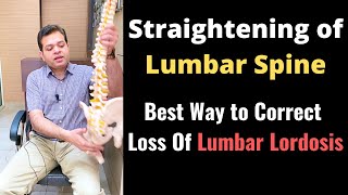 Straightening of Lumbar Spine Loss of Lumbar Lordosis Treatment How to Correct Lumbar Curvature [upl. by Haem]