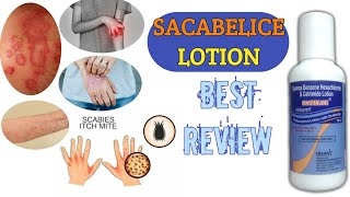 Scabelice Lotion Uses  Scabies Khujli Scabicide  Gamma Benzene Hexachloride amp Cetrimide [upl. by Batha]