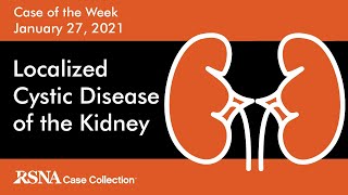 Case of the Week Localized Cystic Disease of the Kidney [upl. by Lombardo613]